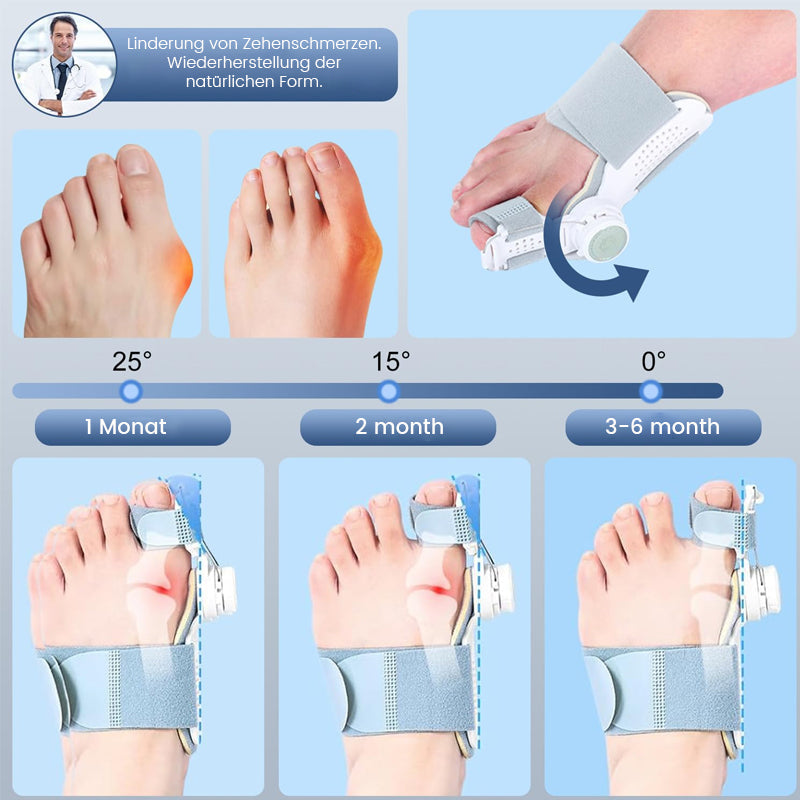 🔥2025 New Arrival 🔥Ergonomic Hallux Valgus Orthosis